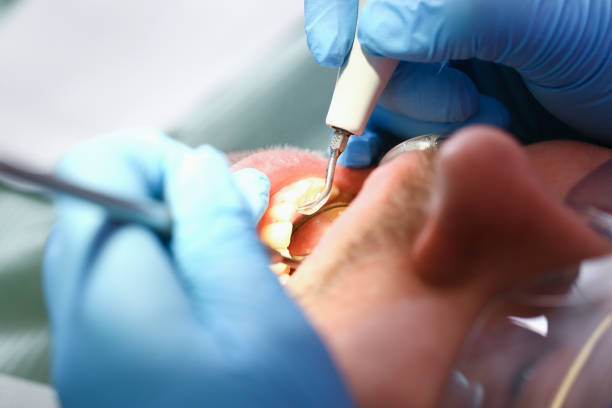 Best Knocked-Out Tooth Emergency  in North Sea, NY